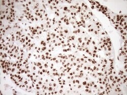 EXOSC1 Monoclonal Antibody (OTI1H9), TrueMAB , OriGene 100 &mu;L | Buy Online | OriGene | Fisher Scientific