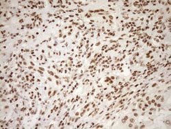 EXOSC1 Monoclonal Antibody (OTI1H9), TrueMAB , OriGene 100 &mu;L | Buy Online | OriGene | Fisher Scientific