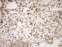 EXOSC1 Monoclonal Antibody (OTI1H9), TrueMAB , OriGene 100 &mu;L | Buy Online | OriGene | Fisher Scientific