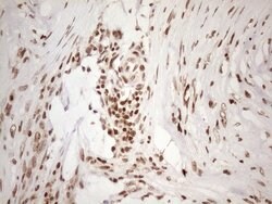 EXOSC1 Mouse anti-Human, Clone: OTI4C7, lyophilized, TrueMAB 100 &mu;g;