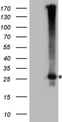 EXOSC1 Mouse anti-Human, Clone: OTI4B7, lyophilized, TrueMAB 100 &mu;g;