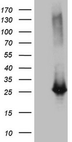 EXOSC1 Monoclonal Antibody (OTI1H9), TrueMAB , OriGene 100 &mu;L | Buy Online | OriGene | Fisher Scientific