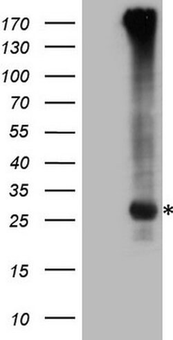 EXOSC1 Mouse anti-Human, Clone: OTI4C7, lyophilized, TrueMAB 100 &mu;g;