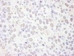 EXOSC10 Rabbit anti-Human, Mouse, Polyclonal, Bethyl Laboratories 100 &mu;L;