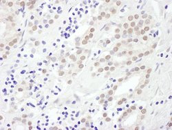 EXOSC10 Rabbit anti-Human, Polyclonal, Bethyl Laboratories 100 &mu;L; Unconjugated:Antibodies,