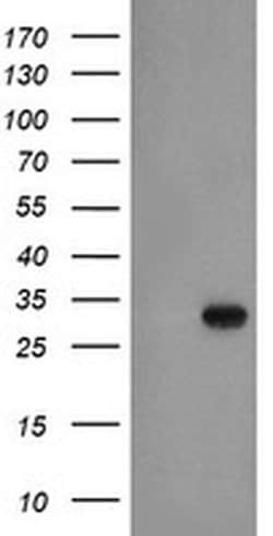 EXOSC3 Monoclonal Antibody (OTI1D6), TrueMAB , OriGene 100 &mu;L; Unconjugated:Antibodies,