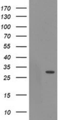 EXOSC3 Mouse anti-Human, Clone: OTI4C9, lyophilized, TrueMAB 100 &mu;g;