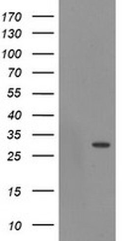 EXOSC3 Monoclonal Antibody (OTI4C9), TrueMAB , OriGene:Antibodies:Primary