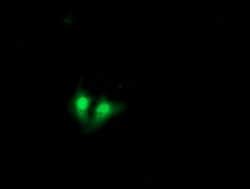 EXOSC7 Mouse anti-Human, Clone: OTI3B2, lyophilized, TrueMAB 100 &mu;g;