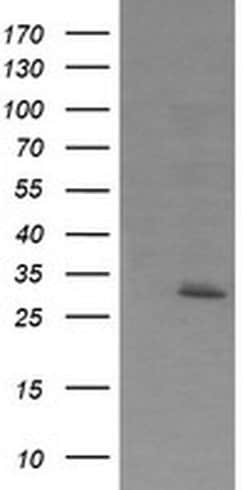 EXOSC7 Monoclonal Antibody (OTI1E8), TrueMAB , OriGene 30 &mu;L | Buy Online | OriGene | Fisher Scientific