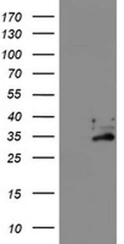 EXOSC7 Monoclonal Antibody (OTI1G8), TrueMAB , OriGene 30 &mu;L; Unconjugated:Antibodies,