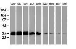 EXOSC7 Monoclonal Antibody (OTI1G8), TrueMAB , OriGene 30 &mu;L; Unconjugated:Antibodies,