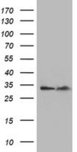 EXOSC7 Mouse anti-Human, Clone: OTI3B2, lyophilized, TrueMAB 100 &mu;g;