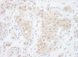 EYA2 Rabbit anti-Human, Polyclonal, Bethyl Laboratories 100 &mu;l; Unlabeled:Antibodies,