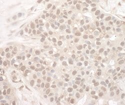 EYA2 Polyclonal Antibody, Bethyl Laboratories 100 &mu;l; Unlabeled:Antibodies,