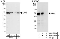 EYA3 Rabbit anti-Human, Polyclonal, Bethyl Laboratories 100 &mu;L; Unconjugated:Antibodies,