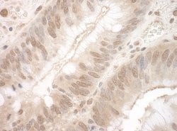 EYA3 Polyclonal Antibody, Bethyl Laboratories 100 &mu;L; Unconjugated:Antibodies,