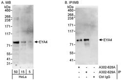 EYA4 Rabbit anti-Human, Polyclonal, Bethyl Laboratories 100 &mu;L; Unconjugated:Antibodies,