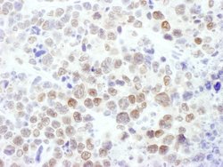 EZH2 Rabbit anti-Human, Mouse, Polyclonal, Bethyl Laboratories 100 &mu;L;