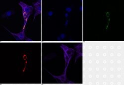 Invitrogen TM111 Recombinant Rabbit Monoclonal Antibody (3H4L5) 100 &mu;g | Buy Online | Invitrogen&trade; | Fisher Scientific