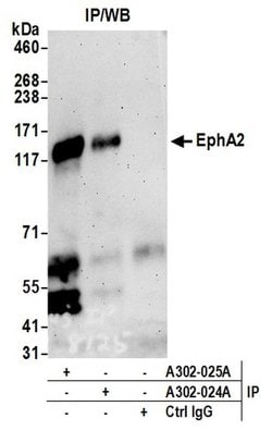 EphA2 Rabbit anti-Human, Mouse, Polyclonal, Bethyl Laboratories 100 &mu;L;