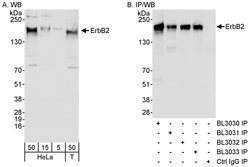 ErbB2 Rabbit anti-Human, Polyclonal, Bethyl Laboratories 100 &mu;L; Unconjugated:Antibodies,