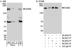 ErbB2 Rabbit anti-Human, Polyclonal, Bethyl Laboratories 100 &mu;l; Unlabeled:Antibodies,