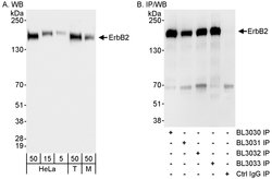 ErbB2 Rabbit anti-Human, Polyclonal, Bethyl Laboratories 100 &mu;L; Unconjugated:Antibodies,