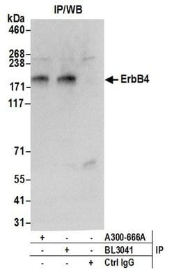 ErbB4 Rabbit anti-Human, Polyclonal, Bethyl Laboratories 10 &mu;L; Unconjugated:Antibodies,