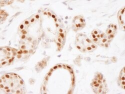 Estrogen Receptor Alpha Rabbit anti-Human, Polyclonal, Bethyl Laboratories