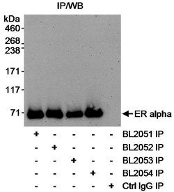 Estrogen Receptor Alpha Rabbit anti-Human, Polyclonal, Bethyl Laboratories