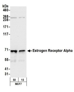 Estrogen Receptor Alpha Polyclonal Antibody, Bethyl Laboratories 20 &mu;L;