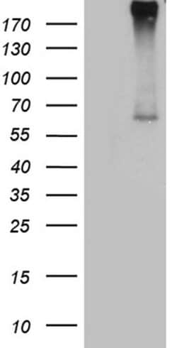 F10 Monoclonal Antibody (OTI1B8), TrueMAB , OriGene:Antibodies:Primary
