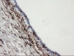 F13A1 Monoclonal Antibody (OTI1H2), TrueMAB , OriGene 100 &mu;L; Unconjugated:Antibodies,