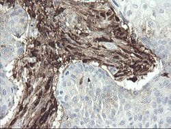 F13A1 Monoclonal Antibody (OTI1H2), TrueMAB , OriGene 100 &mu;L; Unconjugated:Antibodies,