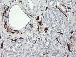 F13A1 Monoclonal Antibody (OTI1H2), TrueMAB , OriGene 100 &mu;L; Unconjugated:Antibodies,