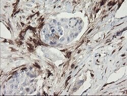 F13A1 Monoclonal Antibody (OTI1H2), TrueMAB , OriGene 100 &mu;L; Unconjugated:Antibodies,