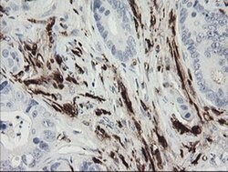 F13A1 Monoclonal Antibody (OTI1H2), TrueMAB , OriGene 100 &mu;L; Unconjugated:Antibodies,