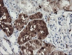 F13A1 Monoclonal Antibody (OTI1H2), TrueMAB , OriGene 100 &mu;L; Unconjugated:Antibodies,
