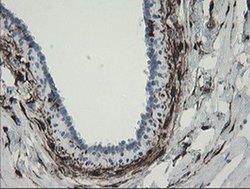 F13A1 Monoclonal Antibody (OTI3E3), TrueMAB , OriGene 100 &mu;L; Unconjugated:Antibodies,