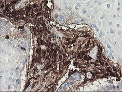 F13A1 Monoclonal Antibody (OTI3E3), TrueMAB , OriGene 100 &mu;L; Unconjugated:Antibodies,