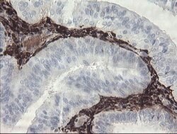 F13A1 Monoclonal Antibody (OTI3E3), TrueMAB , OriGene 100 &mu;L; Unconjugated:Antibodies,