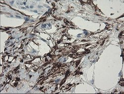 F13A1 Monoclonal Antibody (OTI3E3), TrueMAB , OriGene 100 &mu;L; Unconjugated:Antibodies,