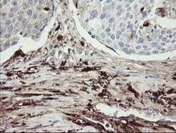 F13A1 Monoclonal Antibody (OTI3E3), TrueMAB , OriGene:Antibodies:Primary