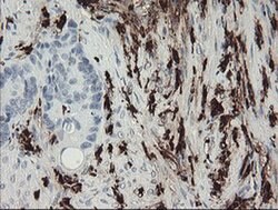 F13A1 Monoclonal Antibody (OTI3E3), TrueMAB , OriGene 100 &mu;L; Unconjugated:Antibodies,