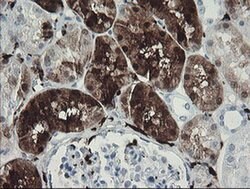 F13A1 Monoclonal Antibody (OTI3E3), TrueMAB , OriGene 100 &mu;L; Unconjugated:Antibodies,