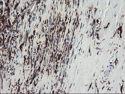 F13A1 Monoclonal Antibody (OTI3E3), TrueMAB , OriGene 100 &mu;L; Unconjugated:Antibodies,