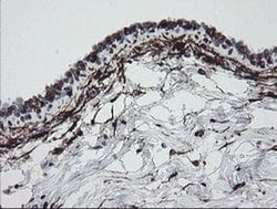 F13A1 Monoclonal Antibody (OTI6F5), TrueMAB , OriGene 100 &mu;L; Unconjugated:Antibodies,