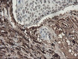 F13A1 Monoclonal Antibody (OTI6F5), TrueMAB , OriGene 100 &mu;L; Unconjugated:Antibodies,