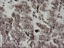 F13A1 Monoclonal Antibody (OTI6F5), TrueMAB , OriGene 100 &mu;L; Unconjugated:Antibodies,